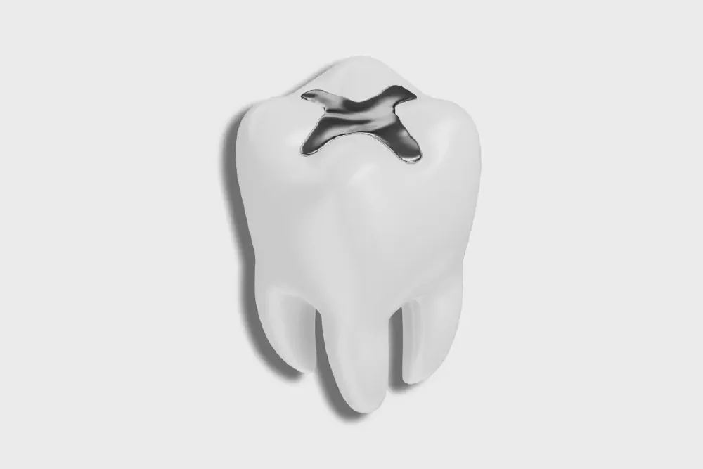 Amalgam Fillings: Safety, Lifespan, Pros and Cons