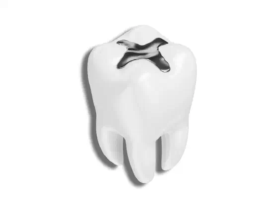 Amalgam Fillings: Safety, Lifespan, Pros and Cons
