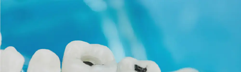 title.webp