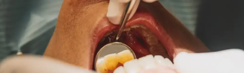 title.webp