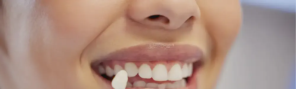 title.webp