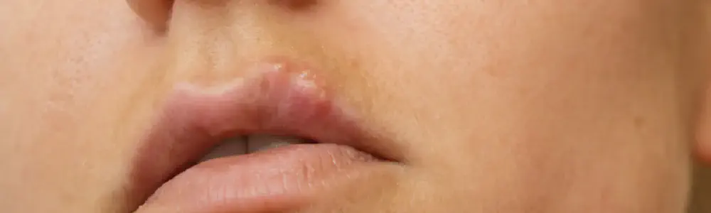 title.webp