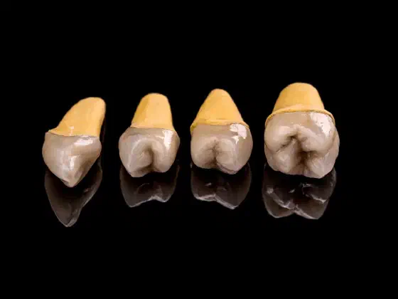 Dead Tooth: Symptoms, Causes and Treatment