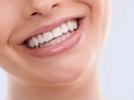 Dental Veneer Aftercare Tips: Keep Your Smile Beautiful
