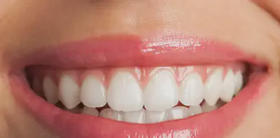 Image for title.webp