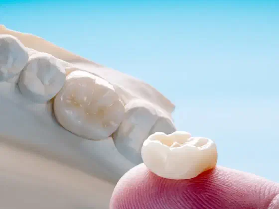 Caring for Your Crowns & Bridges — Dentist-Approved Guide