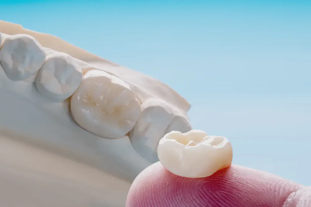 Caring for Your Crowns & Bridges — Dentist-Approved Guide