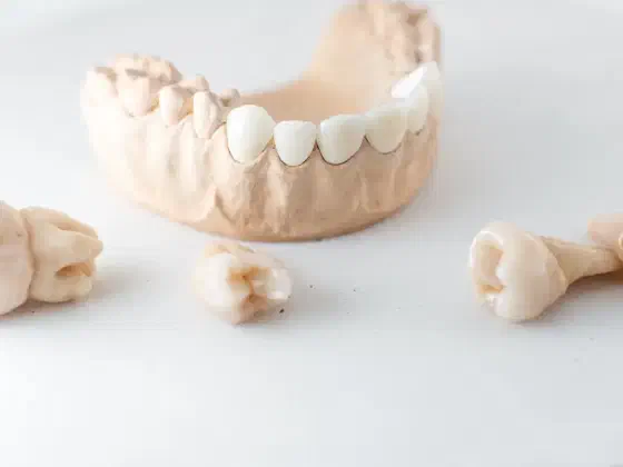 Hyperdontia (Extra Teeth): Causes and Treatment