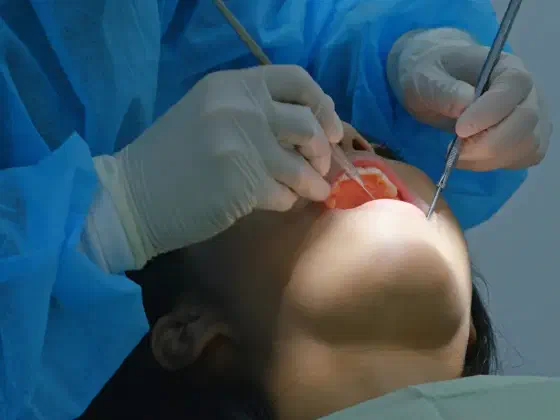 Hypodontia (Missing Teeth): Causes and Treatment