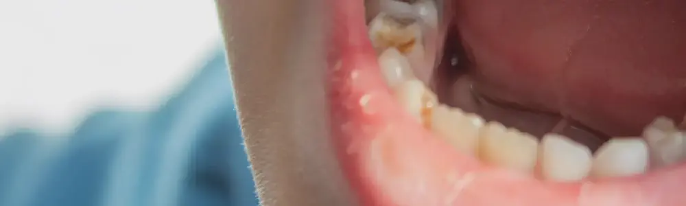 title.webp