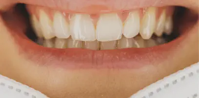 Image for title.webp