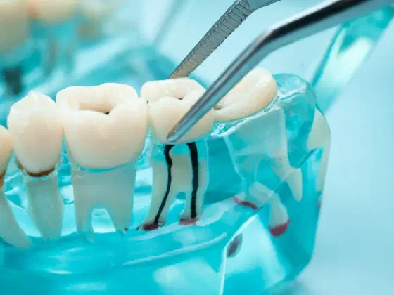 Wisdom Tooth Pain: Causes, Relief and When to Call