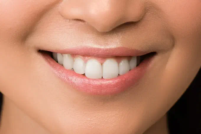 White teeth