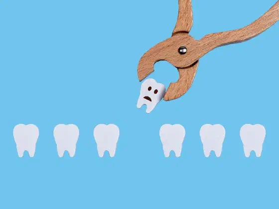 Tooth Extractions in Rancho Cucamonga
