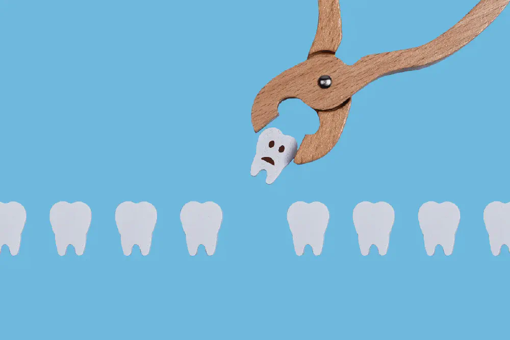 Tooth Extractions in Rancho Cucamonga