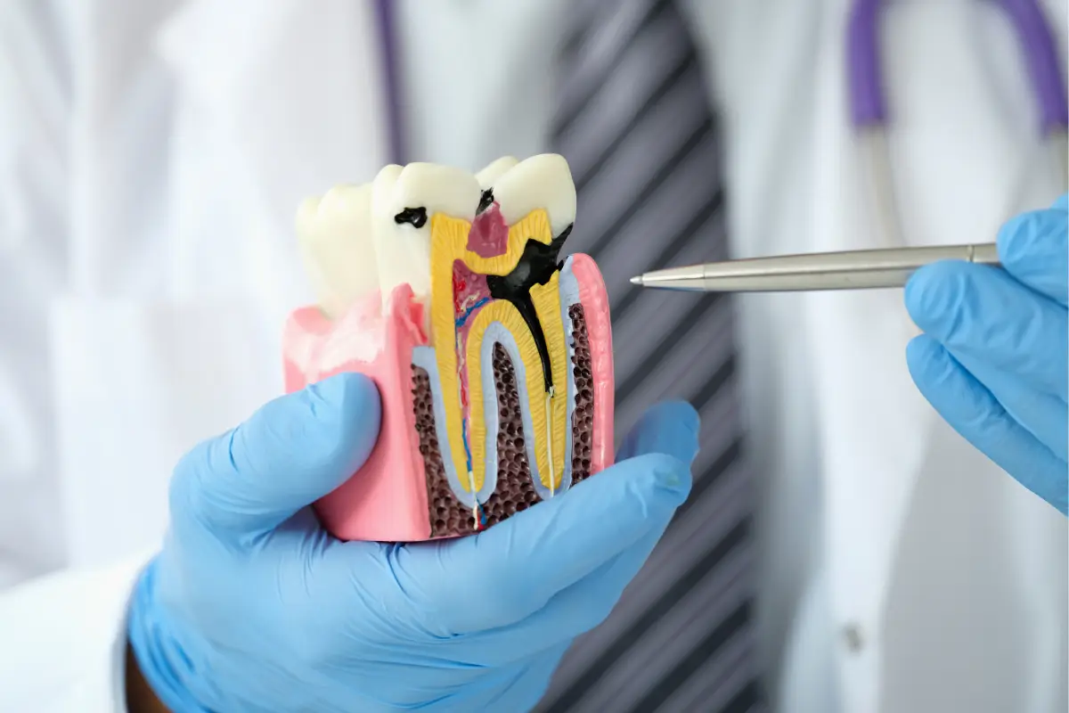 A model teeth of root canal