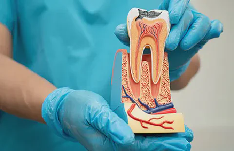 We offer Root Canal in Rancho Cucamonga