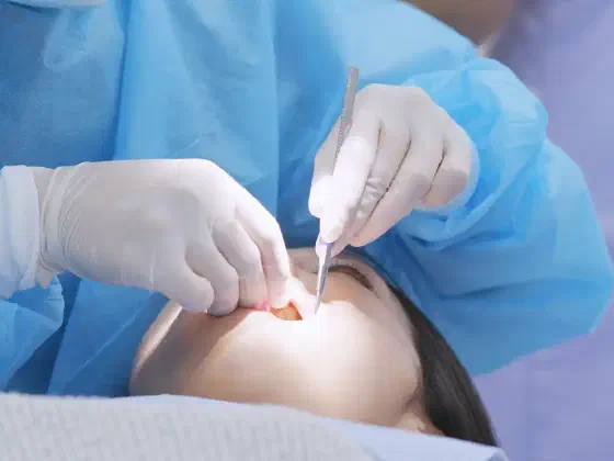 Wisdom Teeth Removal in Rancho Cucamonga