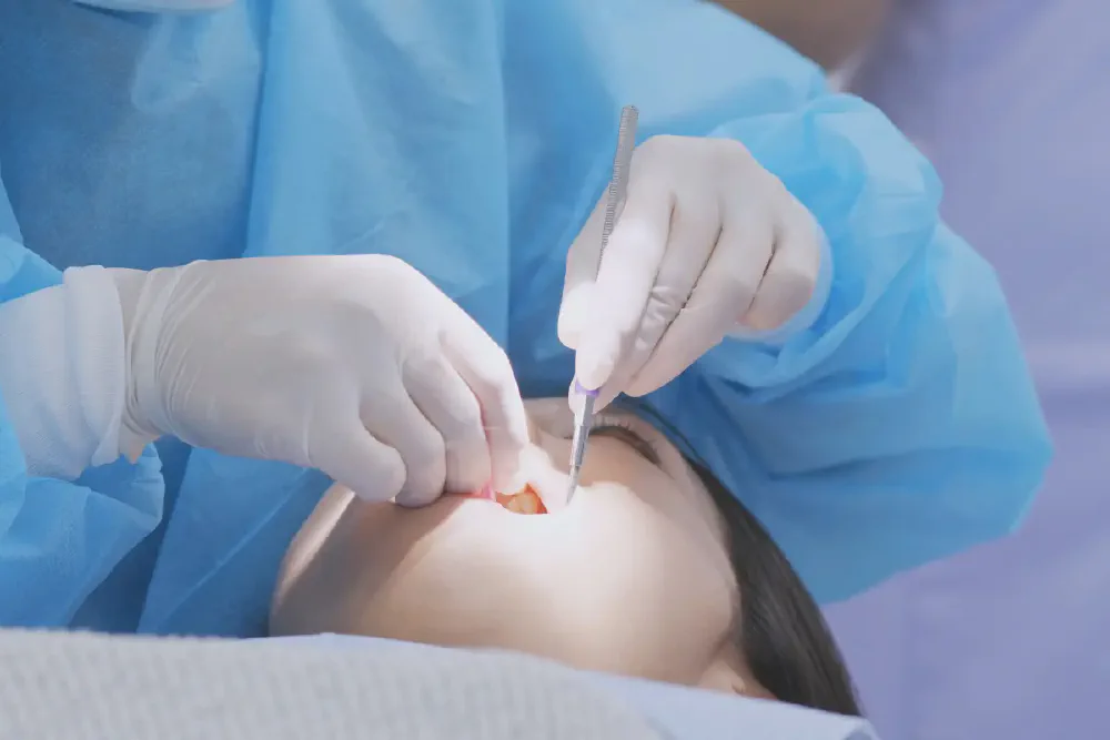 Wisdom Teeth Removal in Rancho Cucamonga