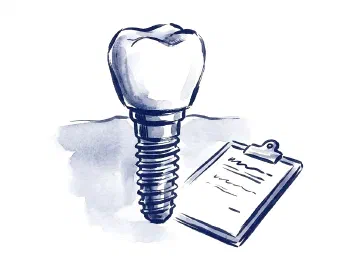 Ink illustration of a dental implant crown and post beside a consultation clipboard