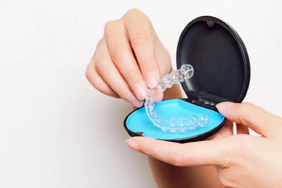 Image of Clear Aligners