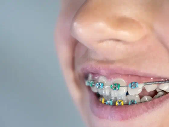 Straighten Your Smile with Orthodontic Care