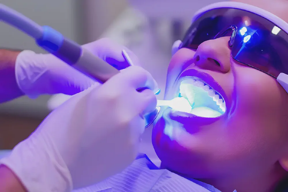 Professional Fluoride Treatment: Benefits and Aftercare