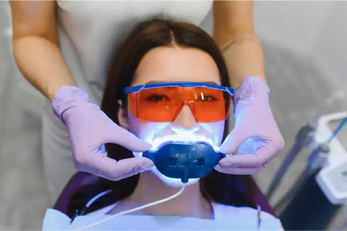 Teeth Whitening done by a dentist