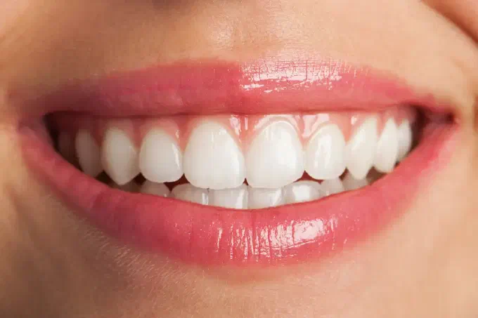 White Teeth