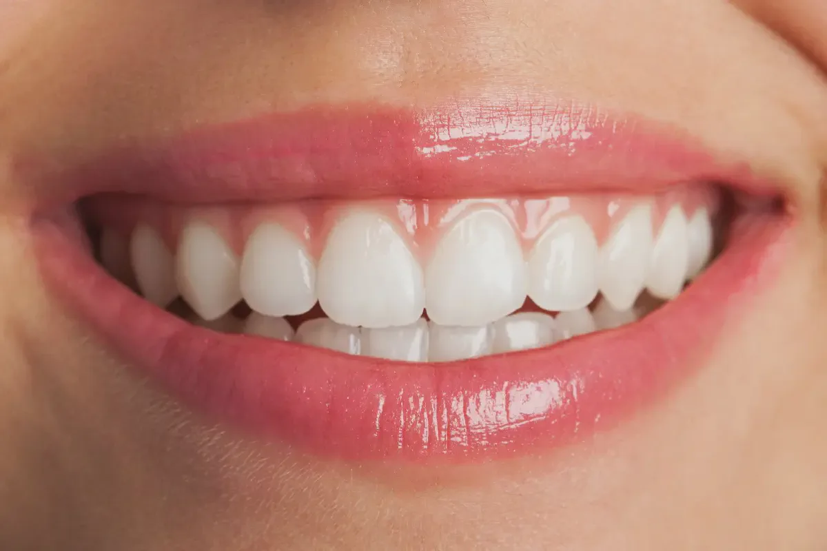White Teeth