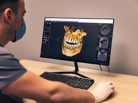 Dental crown designed on a computer screen from a 3D scan